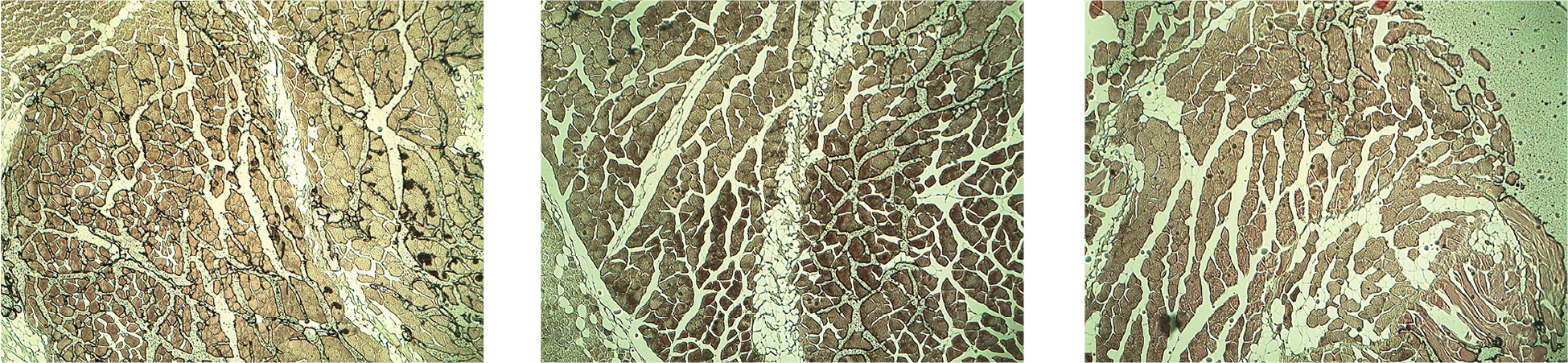 対照通常サイズ群：断面図